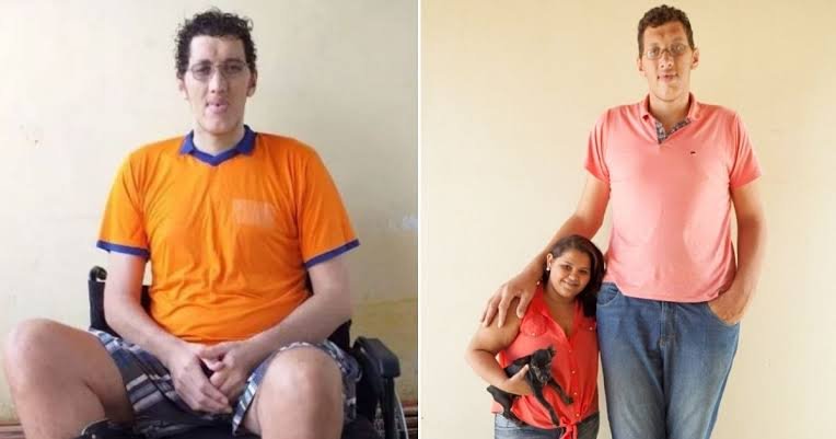 Homem mais alto do Brasil marca cirurgia para amputar perna: “melhorar a minha saúde”
