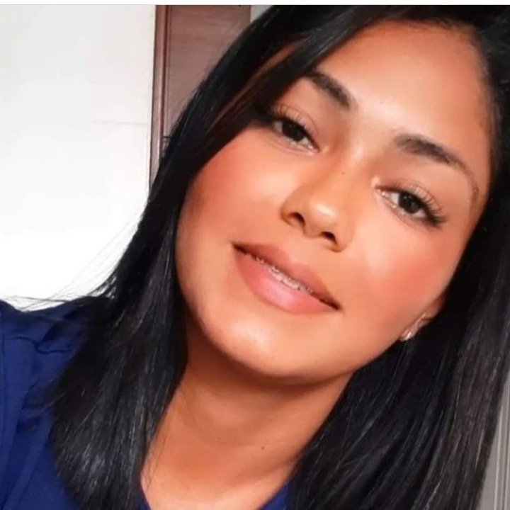 É grave o estado de saúde da jovem baleada enquanto ia celebrar o aniversário