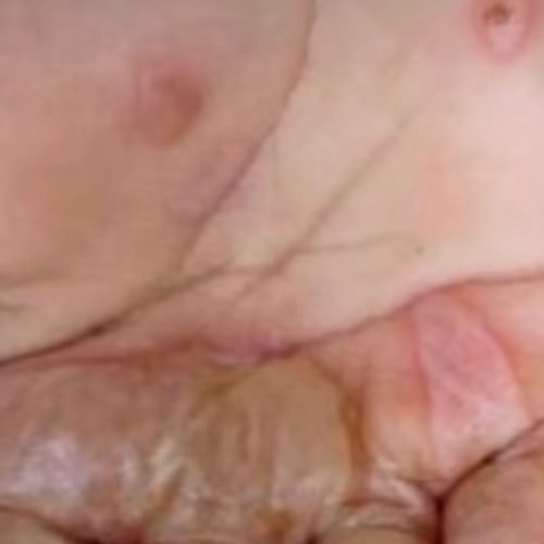 Mãe é presa por queimar mãos da própria filha como ‘punição’ em João Pessoa