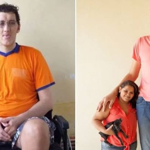Homem mais alto do Brasil marca cirurgia para amputar perna: “melhorar a minha saúde”