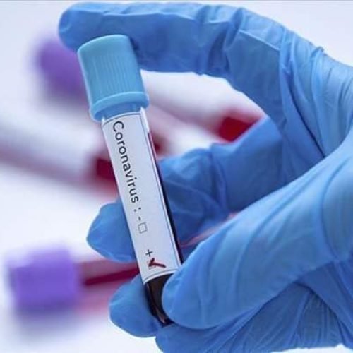 Homem de 60 anos que voltou da Europa é 1º caso confirmado de coronavirus na PB