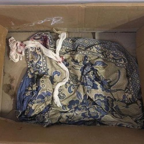 Homem tenta matar cachorro com três facadas em Santa Rita