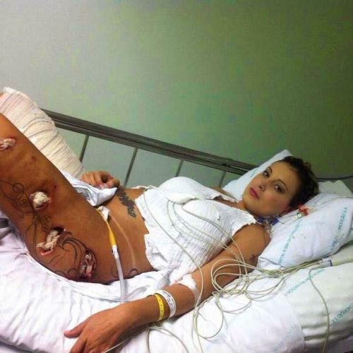 Andressa Urach faz novo procedimento no bumbum